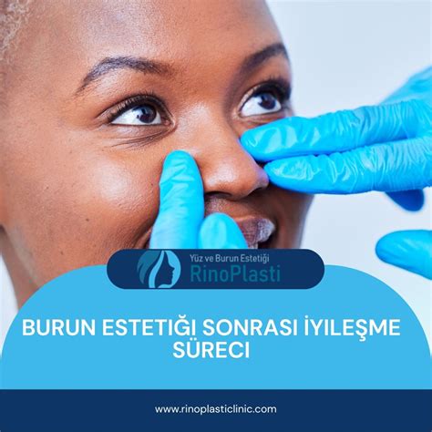 Burun Estetiği Sonrası İşe Dönüş Süreci